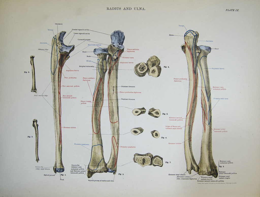 Anatomical plate of radius and ulna