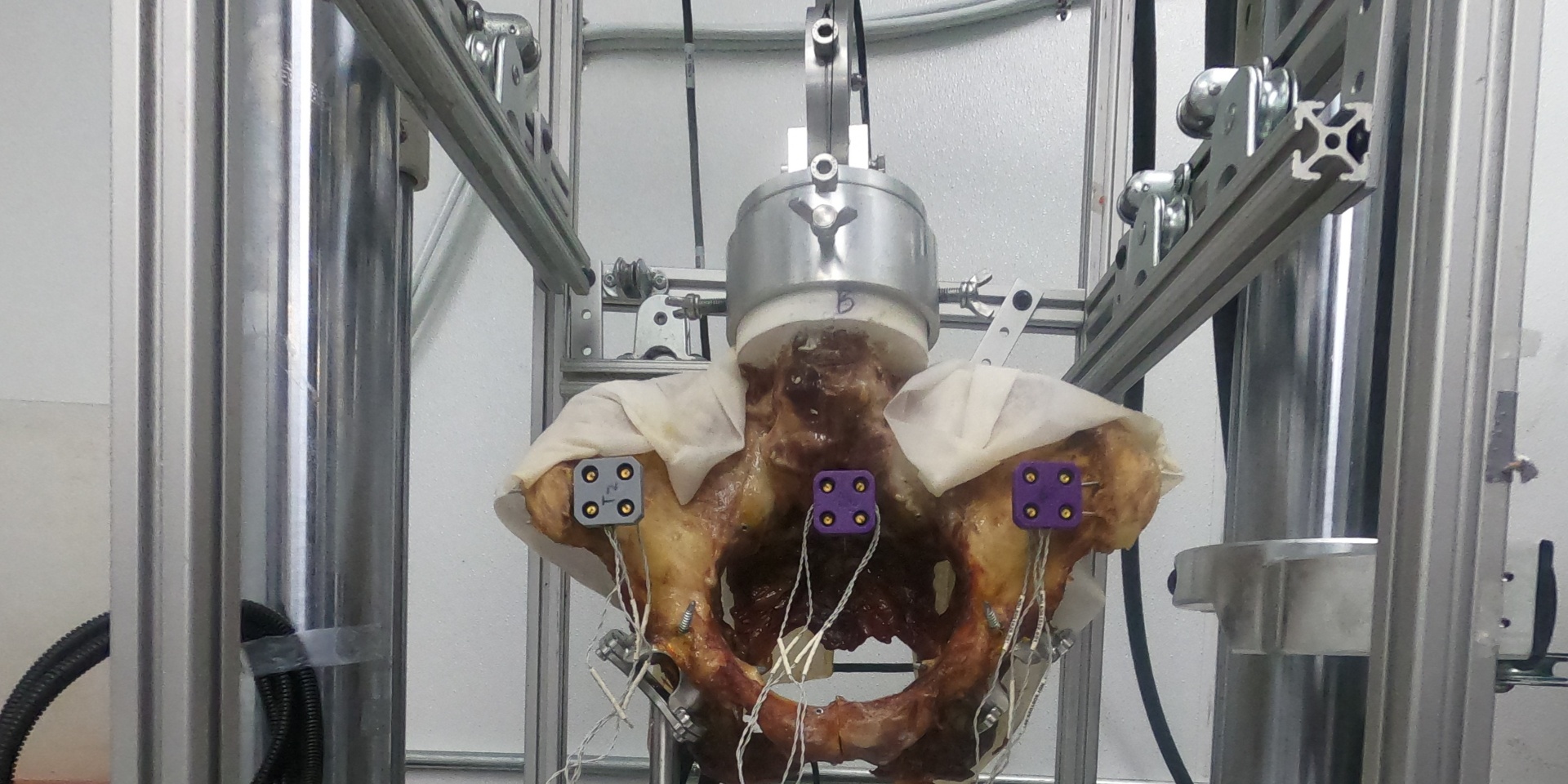 Cadaveric pelvis instrumented with optical tracking markers in a custom aluminum test frame